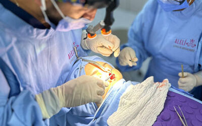Rinoplastia funcional en Ecuador