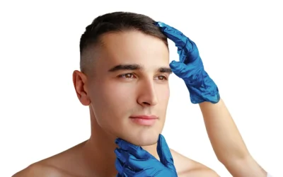 Rinoplastia Masculina en Cuenca: 10 Consejos Esenciales