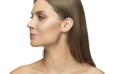 Rinoplastia con resultados naturales en Cuenca