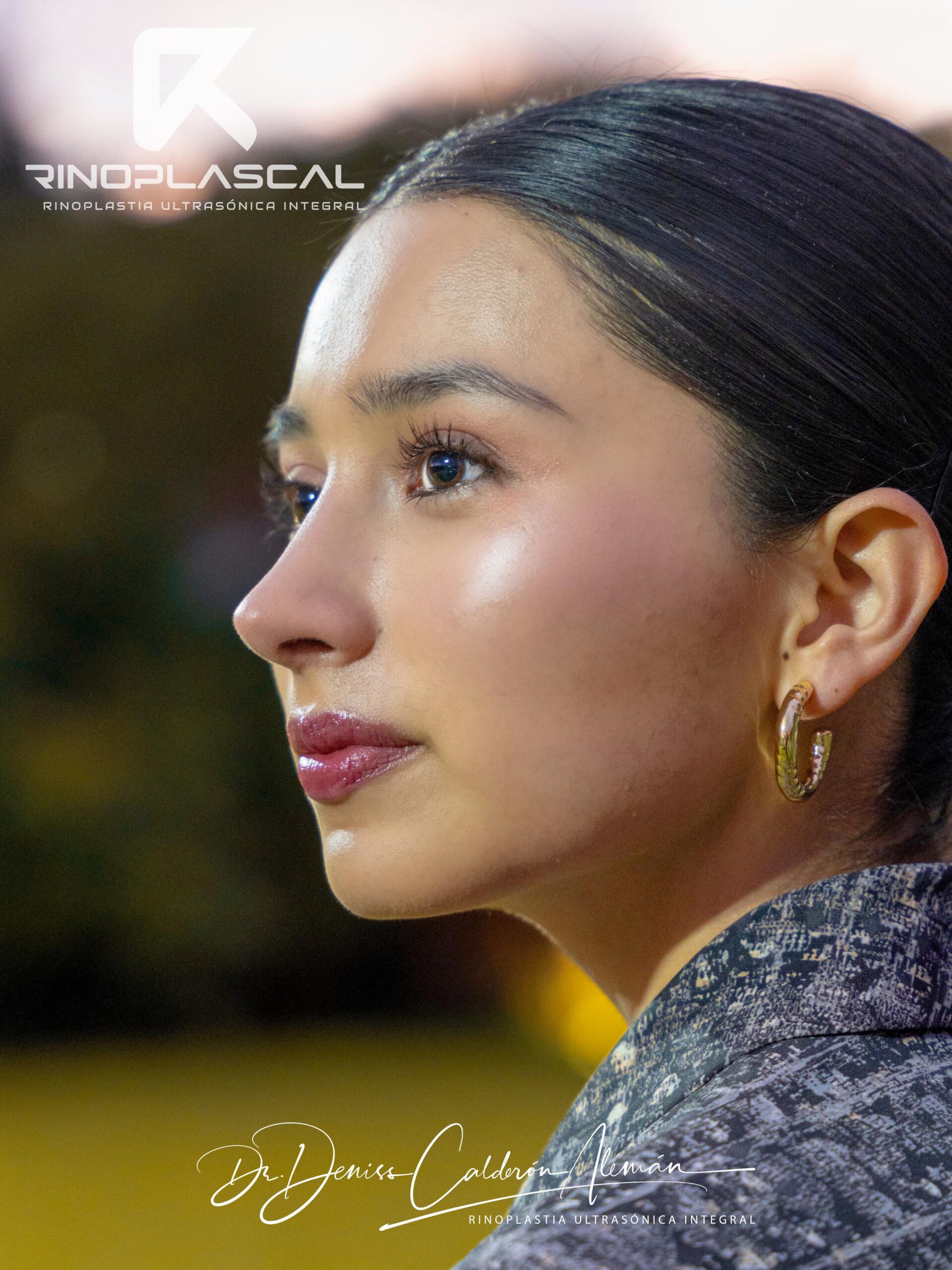 rinoplastia-en-cuenca-dr-deniss-calderon