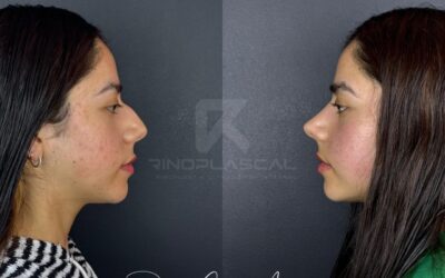 Medicina Estética en Ecuador | Dr. Dennis Calderón