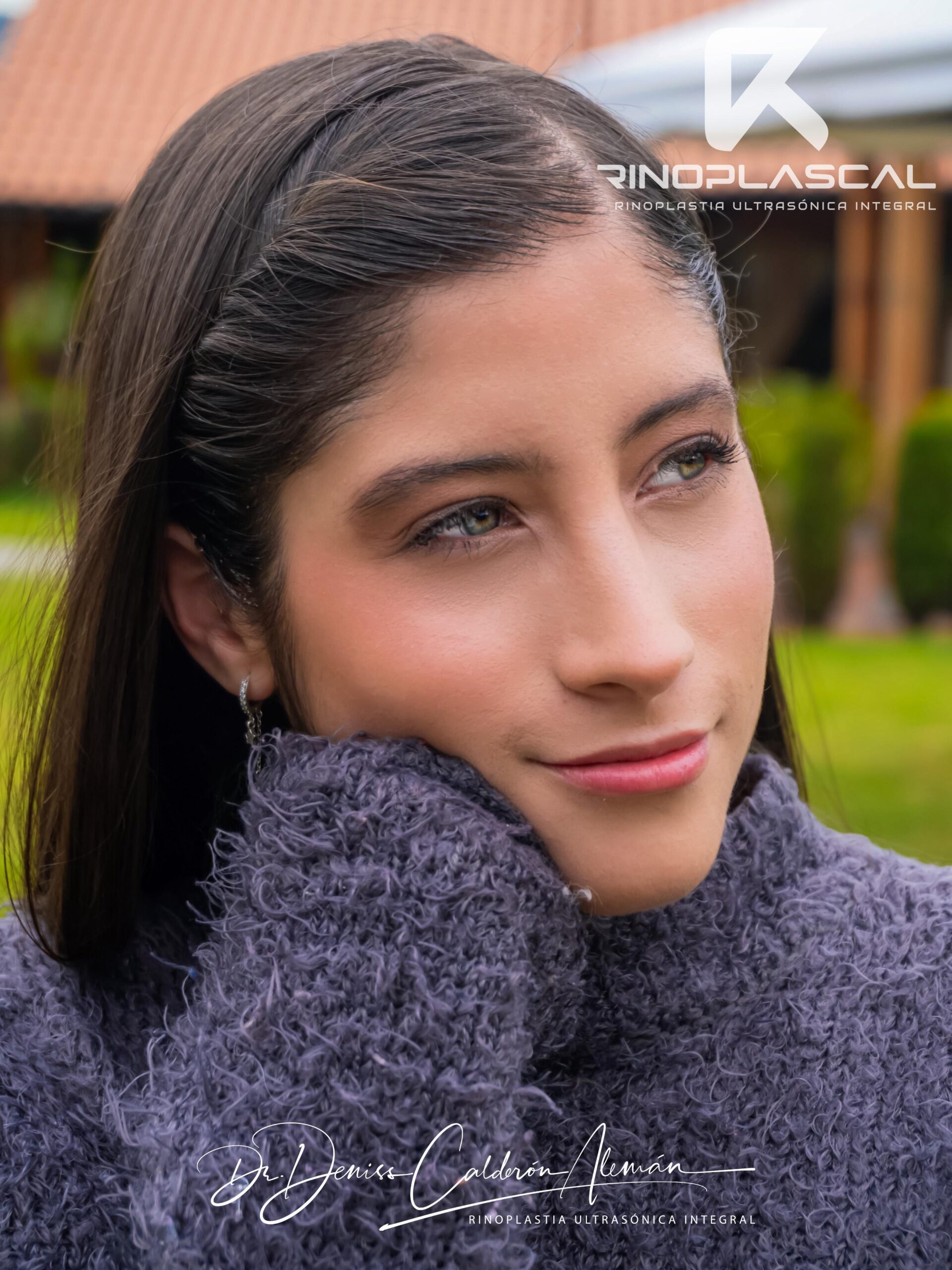 rinoplastia-en-cuenca-dr-deniss-calderon