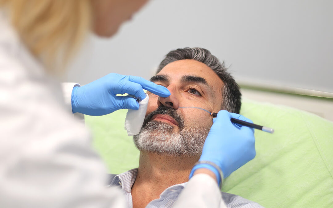 ¿Cuándo realizar una rinoplastia ultrasónica?