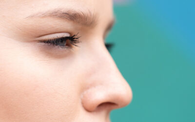 Recuperación después de una Rinoplastia Ultrasónica