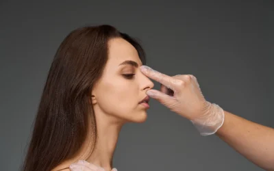 Rinoplastia de preservación nasal en Ecuador: Innovación y resultados naturales